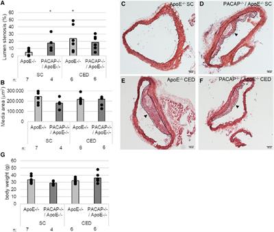 PACAP regulates VPAC1 expression, inflammatory processes and lipid homeostasis in M1- and M2-macrophages